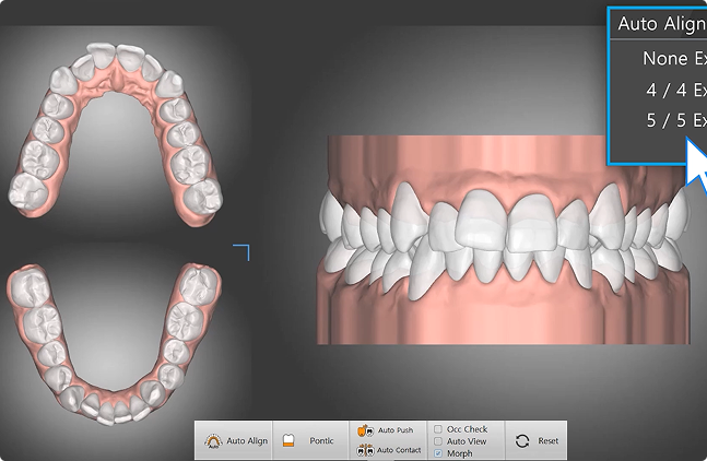 Automatic tooth alignment